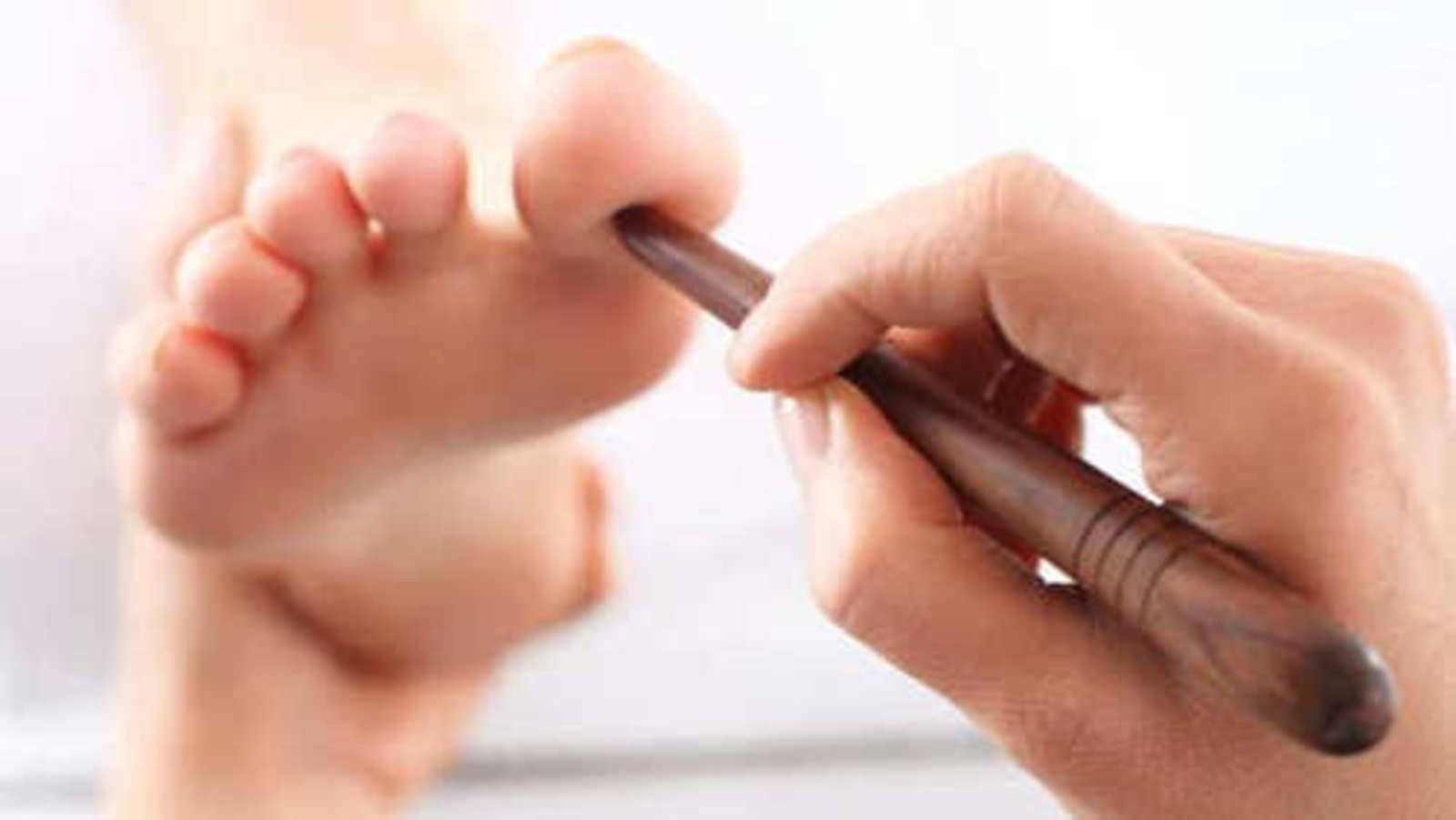 Acupressure therapy